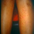 misuse_betadine_pred9-838.jpg