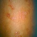 misuse_betadine_pred9-839.jpg