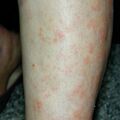 misuse_betageng010118-1.jpg