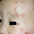 misuse_betageng010702.jpg