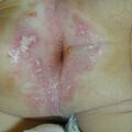 misuse_betageng011227.jpg