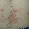 misuse_betageng020826-1.jpg