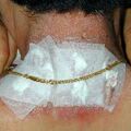 misuse_bonesetter020424-1.jpg