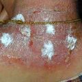misuse_bonesetter020424-2.jpg