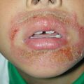 misuse_bosong020529.jpg