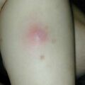 misuse_bosong020719-1.jpg