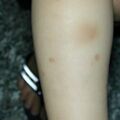 misuse_bosong020719-3.jpg
