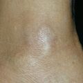 misuse_burn011221-2.jpg
