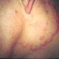 misuse_buruna9-458.jpg