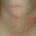 misuse_c-cream010814.jpg