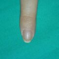 misuse_camio030103-1.jpg