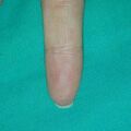 misuse_camio030103-2.jpg