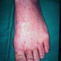 misuse_celatica_tinea2000-89.jpg