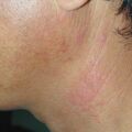 misuse_celestoneg010720-1.jpg