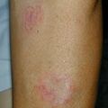 misuse_celestoneg010804.jpg