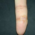 misuse_celestoneg010917-11.jpg