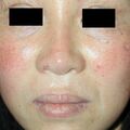 misuse_celestoneg020225-1.jpg