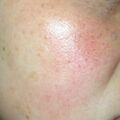misuse_celestoneg020225-2.jpg