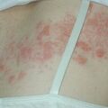 misuse_celestoneg020527.jpg