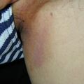 misuse_celestoneg020612.jpg