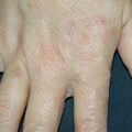 misuse_celestoneg020730-1.jpg