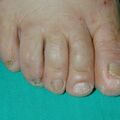 misuse_celestoneg020730-2.jpg
