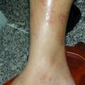 misuse_celestoneg020805-1.jpg