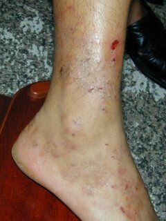 misuse_celestoneg020805-2.jpg