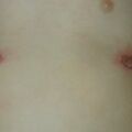 misuse_celestoneg020814-1.jpg