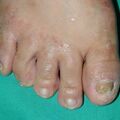 misuse_celestoneg020819-6.jpg