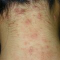 misuse_celestoneg020820-2.jpg