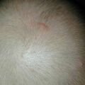 misuse_celestoneg020829.jpg
