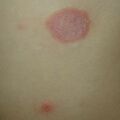 misuse_celestoneg020830-1.jpg