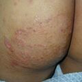 misuse_celestoneg020904-1.jpg