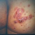 misuse_celestoneg9-725.jpg