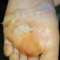 misuse_chitosan010813.jpg
