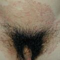 misuse_chmarong010709.jpg