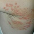 misuse_chmarong010803.jpg