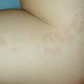 misuse_chmarong010823.jpg