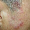 misuse_chmarong020122.jpg