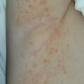 misuse_chmarong020810-2.jpg
