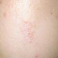 misuse_chmarong020821-1.jpg
