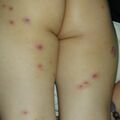 misuse_chmarong_madecassol020706-1.jpg