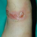 misuse_chmarong_madecassol020706-2.jpg