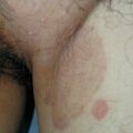 misuse_chmarong_procort020803.jpg