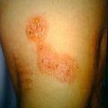 misuse_clo_epigen9-661.jpg