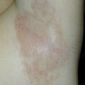 misuse_clobegen010119.jpg