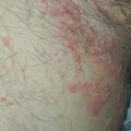 misuse_clobegen010706.jpg