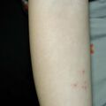 misuse_clobegen020225-1.jpg