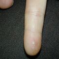 misuse_clobegen020225-2.jpg